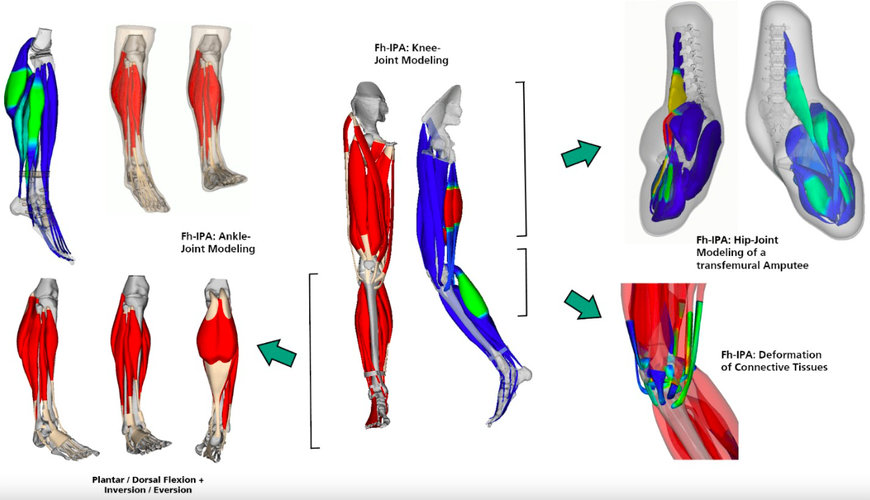 TAILOR-MADE IMPLANTS FOR PATIENTS THANKS TO SIMULATIONS USING VIRTUAL HUMAN MODELLING